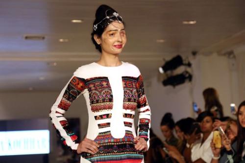 Défigurée à l’acide, elle défile à la Fashion Week de New York