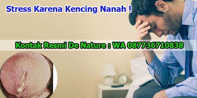 Kelamin Keluar Nanah Dan Cara Mengatasinya Dengan Benar Kelamin Keluar Nanah Dan Cara Mengatasinya Dengan Benar