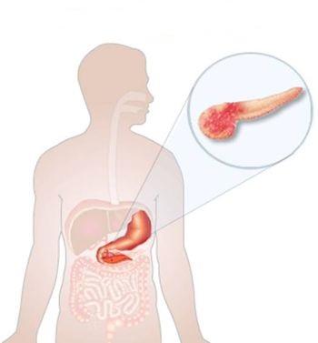 le pancreas