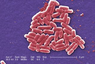 1. Escherichia coli