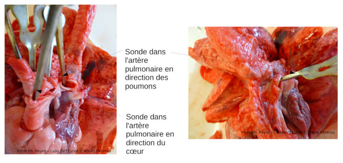 La dissection du bloc coeur-poumons