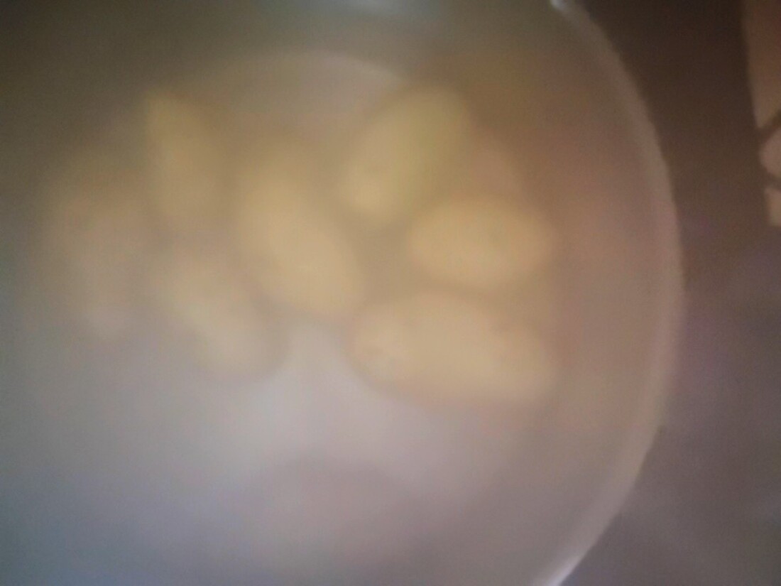 Salade de pommes de terre de mamama.