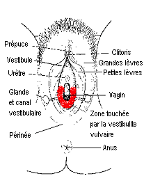 Description médicale