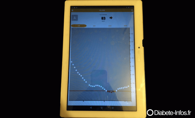 appli follow tablette