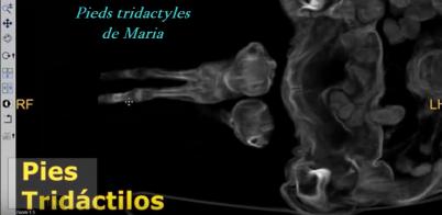 ALIEN PROJECT - Les momies du Pérou/5