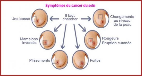 Le Cancer.