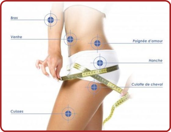 La Cellulite