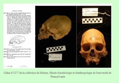 Un crâne étrange découvert