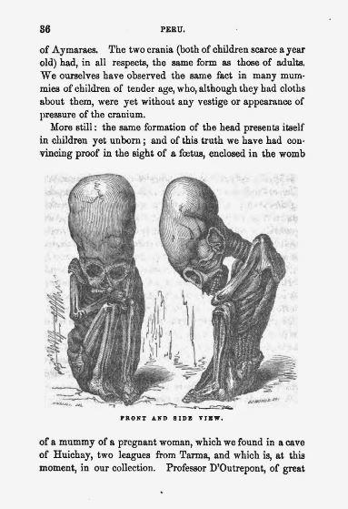 Un crâne étrange découvert