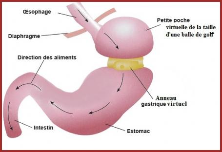 La chirurgie