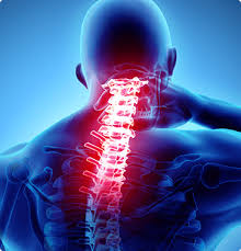 Arthrose Cervicale.