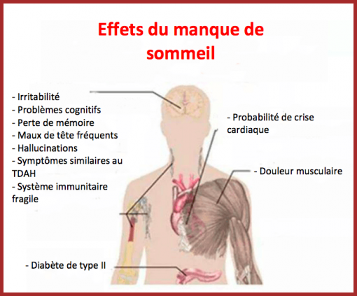 Le Sommeil.