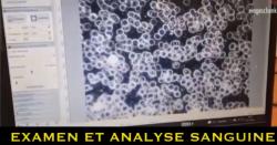 Brèves de Santé
