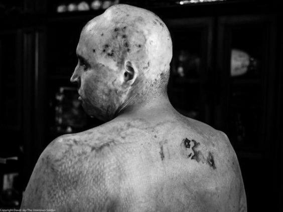 Les Anciens Combattants