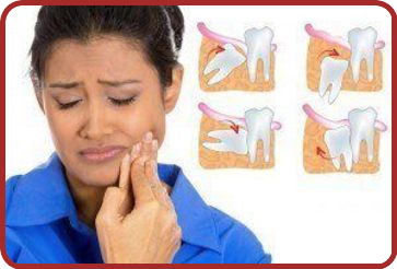 Les Dents