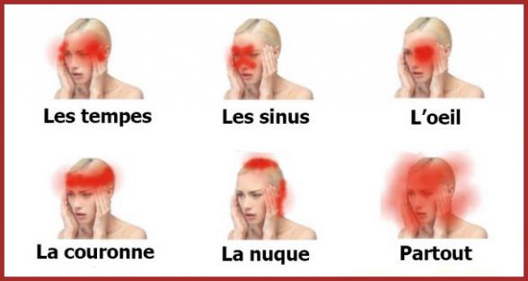 La Tête.
