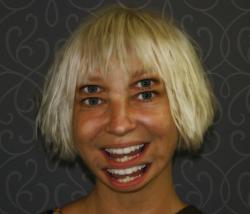 ➤ Lorsque la star Sia Furler révèle la personnalité multiple de son père et sa "bipolarité" (2014)