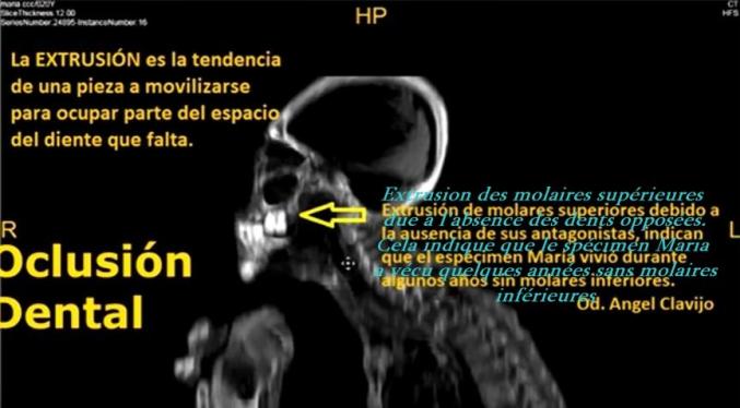 ALIEN PROJECT - Les momies du Pérou/5