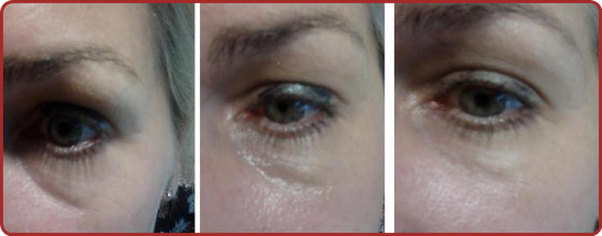 Les Yeux.