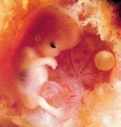 Foetus et estra-terrestres