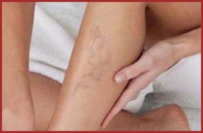 Les Jambes