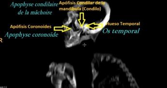 ALIEN PROJECT - Les momies du Pérou/5