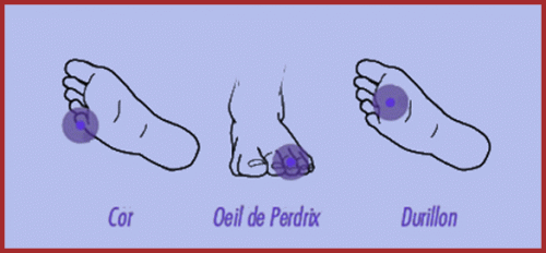 Les Pieds