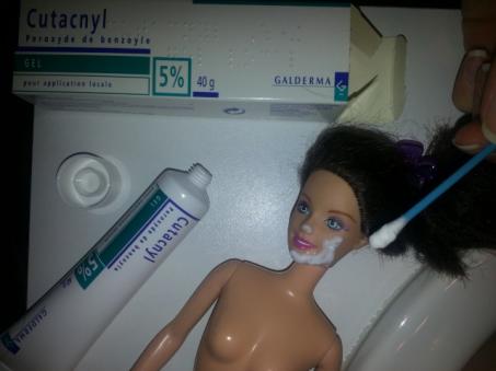 Les tâches sur le vinyle !