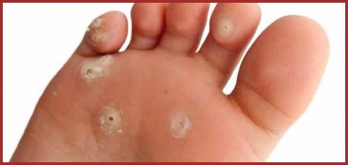 Les Pieds