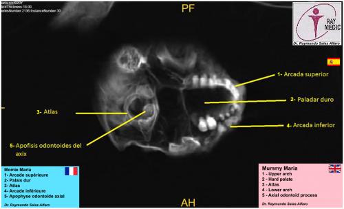 ALIEN PROJECT - Les momies du Pérou/5