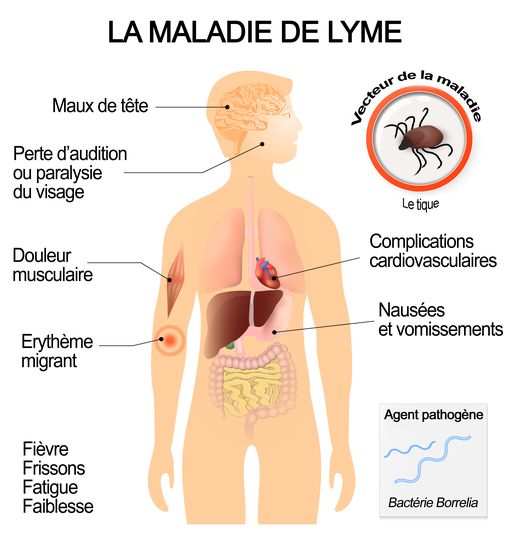 La Tique ! Attention Danger !