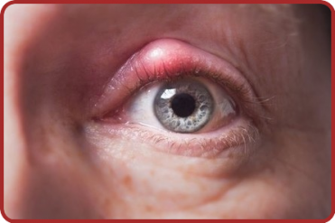 Les Yeux.