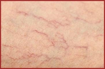 Les Jambes