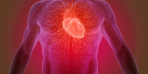 Douleur crise cardiaque