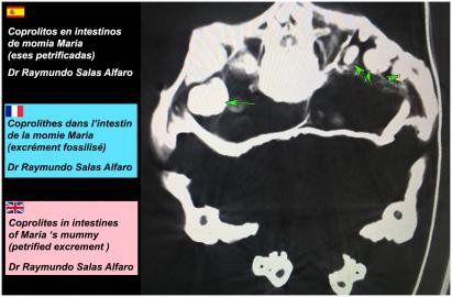 ALIEN PROJECT - Les momies du Pérou/5