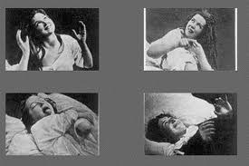 L'Hystérie - Est-elle contagieuse ?