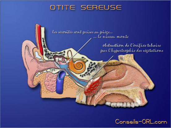 Les Oreilles/Le Nez