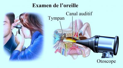 Les Oreilles/Le Nez