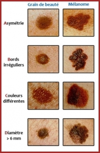 La Peau