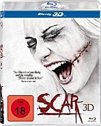 Scar 3D