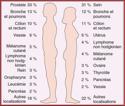 Le Cancer.