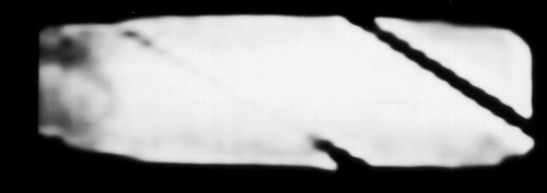 Radiographie par scanner du doigt Radiographie par scanner du doigt